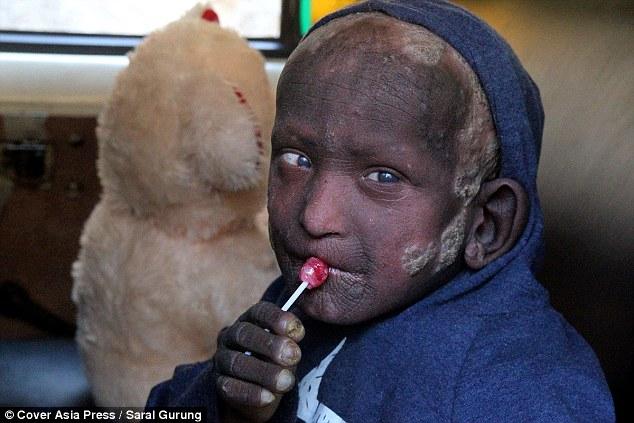 【笑爆】小男孩从出生就「像一颗石头」到现在11岁还无法上学,大家